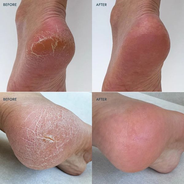 Набір для відновлення п'ят з лавандою - Heel Repair Duo Lavender VFC001LVR фото