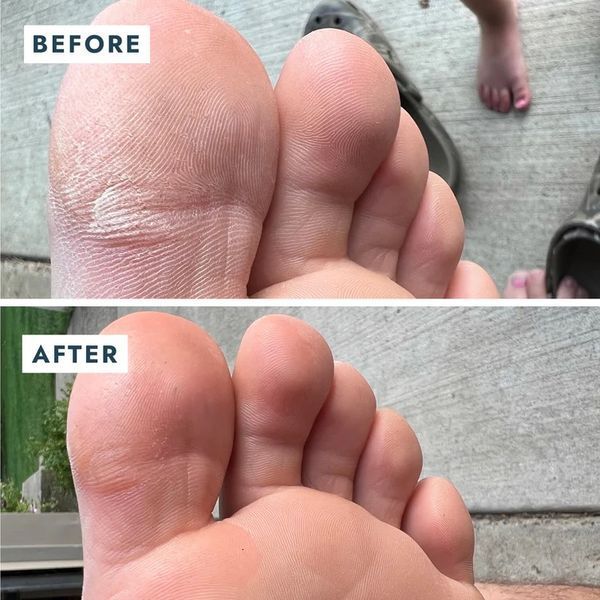 Відновлювальний бальзам для п'ят Solemate Heel Repair Balm VFB022MNT фото