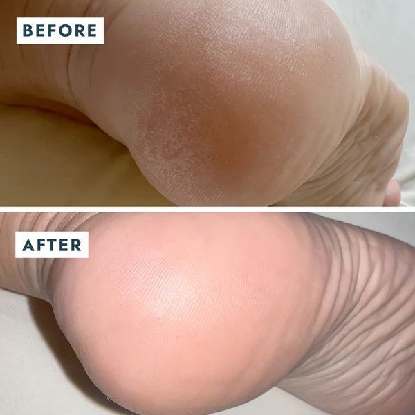 Відновлювальний бальзам для п'ят Solemate Heel Repair Balm VFB022MNT фото