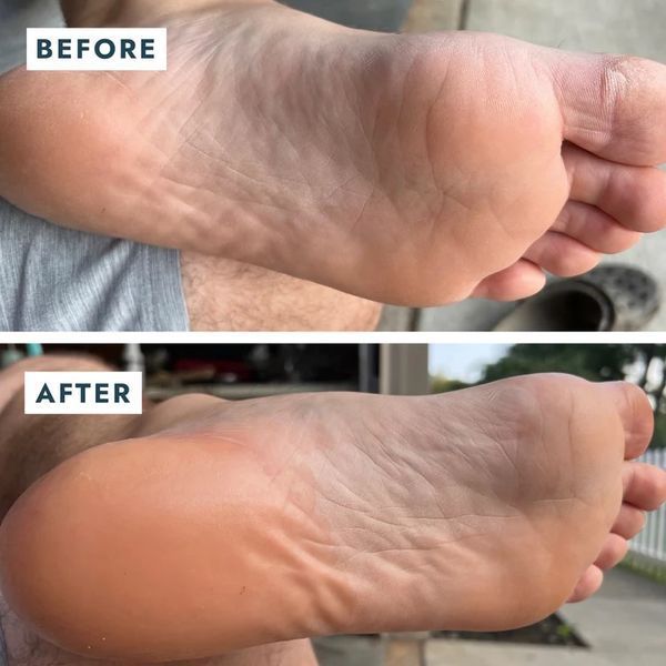 Набір відновлювальний для п'ят Heel Repair Duo більзам +зволожувальні шкарпетки VFC001MNT фото